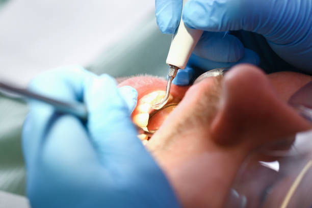 Best Tooth Infection Emergency Dentist  in Coushatta, LA